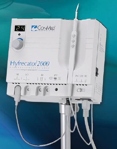 electrosurgery hyfrecator