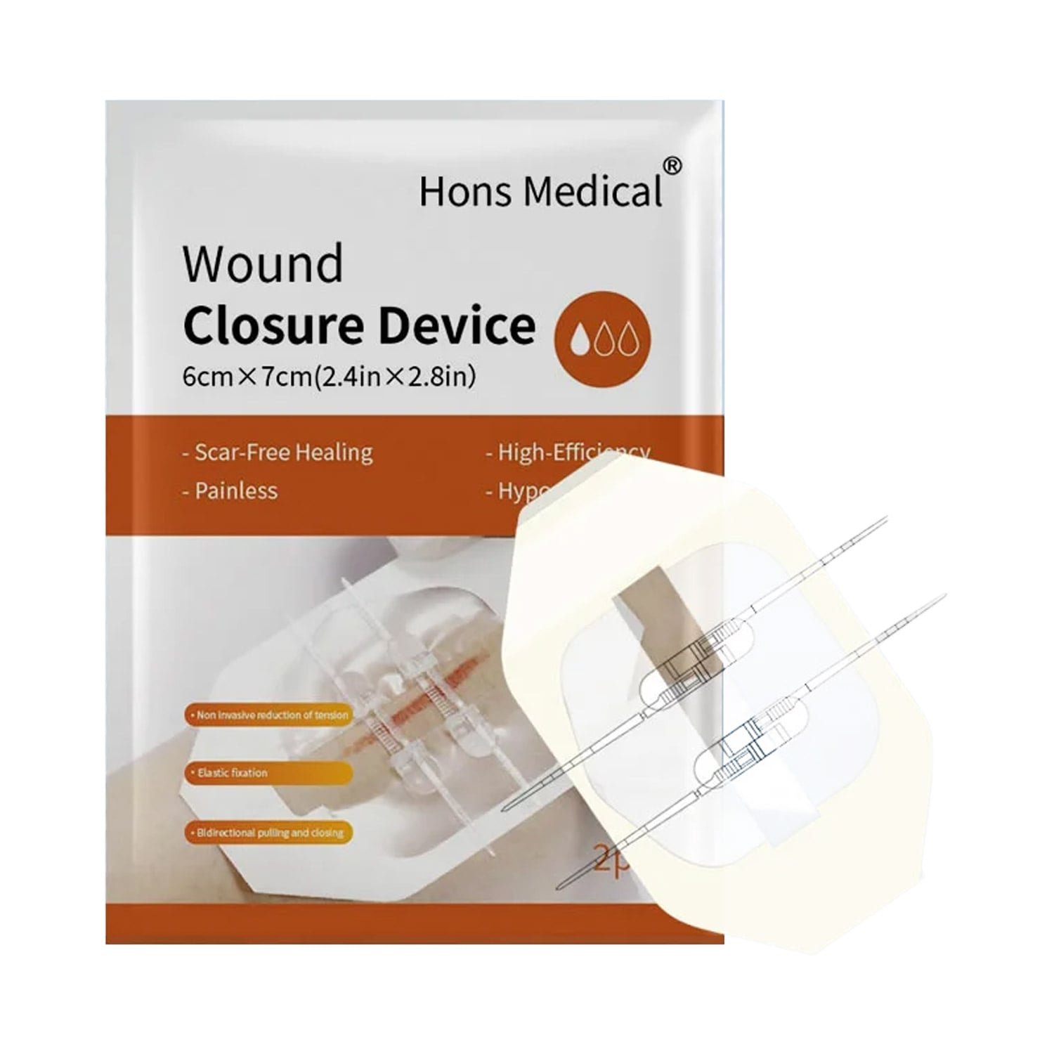 wound closure material2