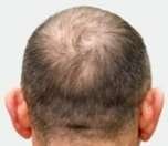 gfc before