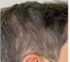 greying of hair s before