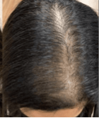 hair gfc after