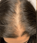 hair gfc before