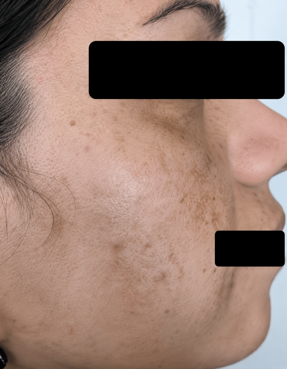 after (30)