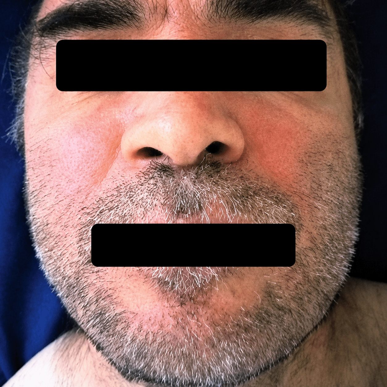 after (34)