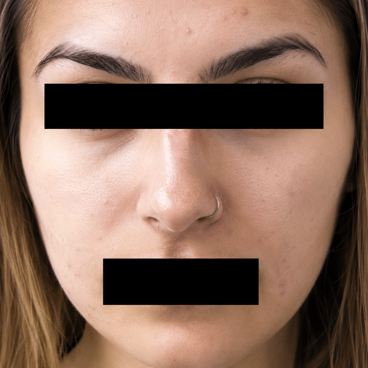before (21)