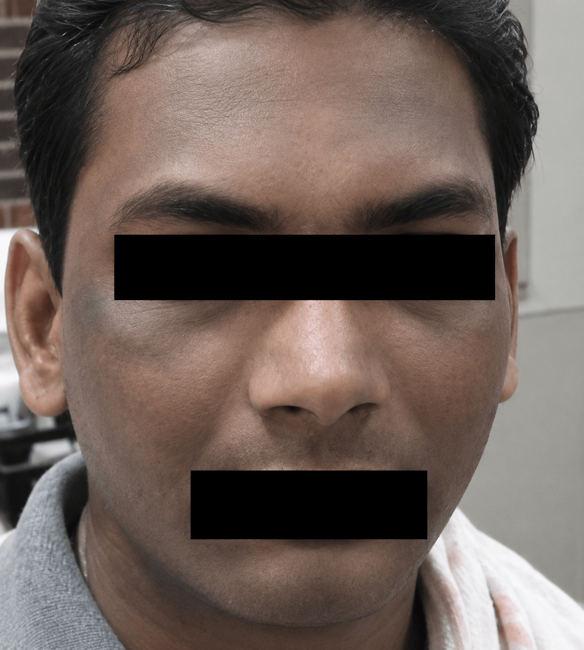 before (23)