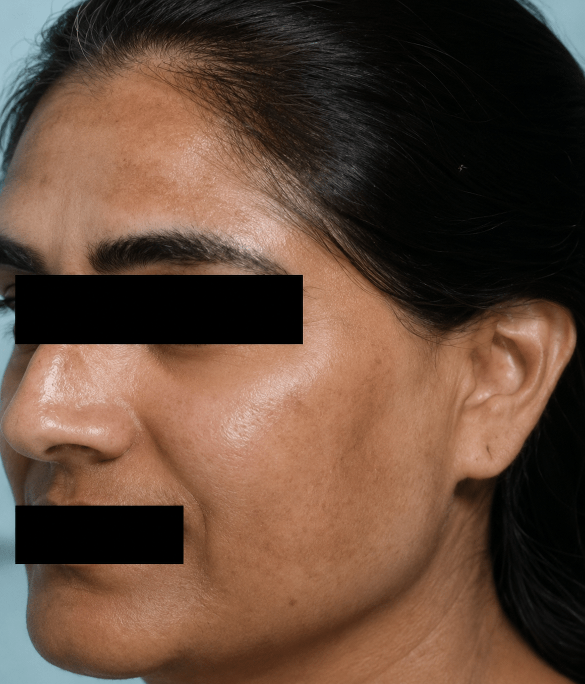 before (28)