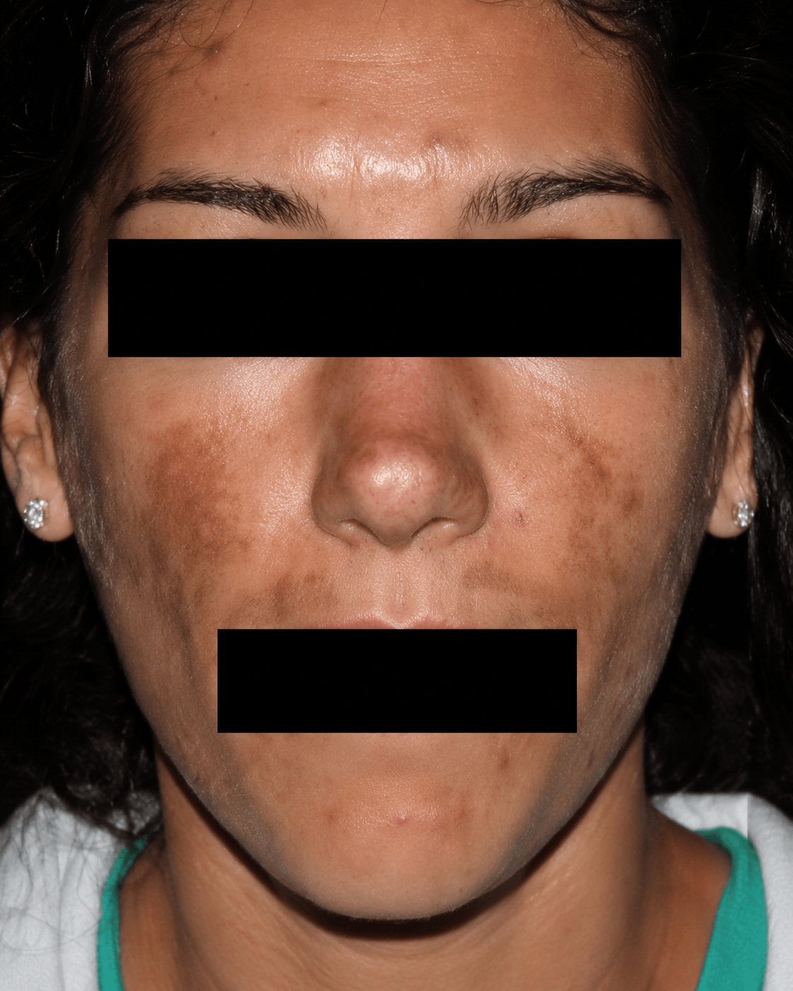 before (29)
