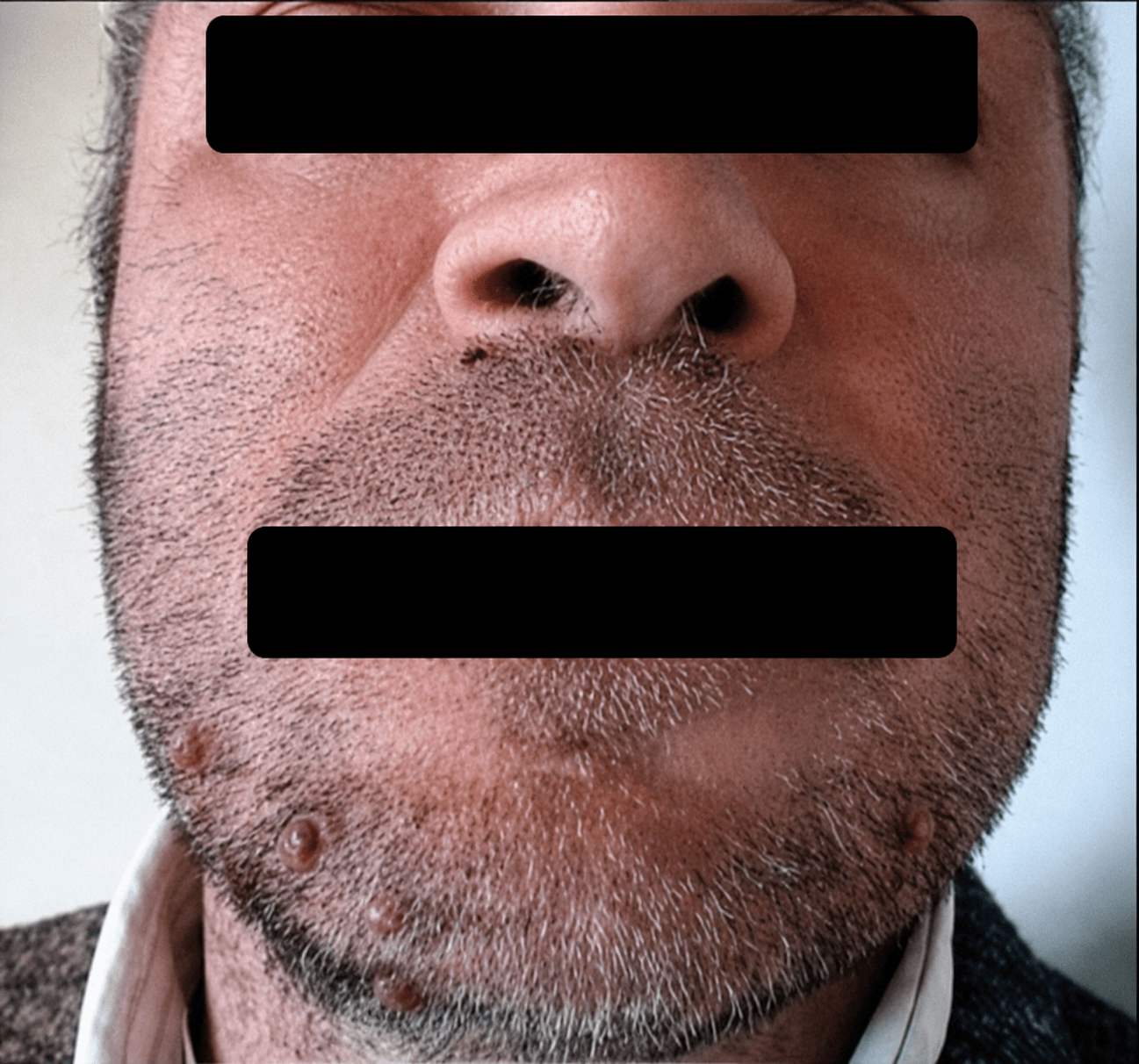 before (34)