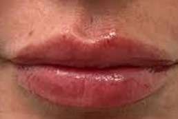 lip f a