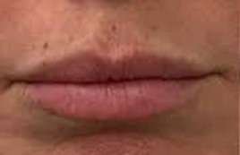 lip f b
