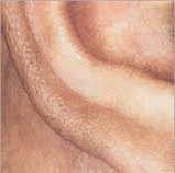 ear hair removal after