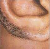 ear hair revomal before