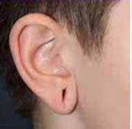 ear loboe repair before