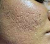 face scar before