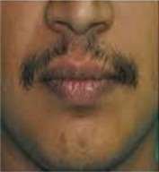 moustache ht b